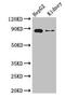 Carnitine Palmitoyltransferase 1A antibody, CSB-PA005922LA01HU, Cusabio, Western Blot image 
