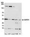 GAPDH antibody, A500-005A, Bethyl Labs, Western Blot image 