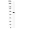 Solute Carrier Family 1 Member 1 antibody, R31284, NSJ Bioreagents, Western Blot image 