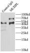 MLX Interacting Protein Like antibody, FNab05224, FineTest, Immunoprecipitation image 