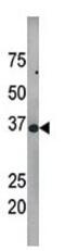 Cyclin Dependent Kinase 7 antibody, ab59987, Abcam, Western Blot image 