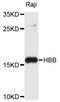 Hemoglobin Subunit Beta antibody, abx125931, Abbexa, Western Blot image 