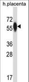 Prolyl 4-Hydroxylase Subunit Alpha 3 antibody, LS-C163327, Lifespan Biosciences, Western Blot image 