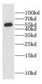 Enhancer Of MRNA Decapping 3 antibody, FNab02630, FineTest, Western Blot image 