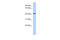 ST3 Beta-Galactoside Alpha-2,3-Sialyltransferase 4 antibody, 26-153, ProSci, Enzyme Linked Immunosorbent Assay image 