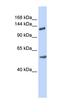 Roundabout Guidance Receptor 2 antibody, orb330412, Biorbyt, Western Blot image 