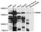 RNA Binding Motif Protein 6 antibody, STJ112427, St John