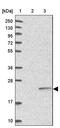 Zinc Finger Protein 501 antibody, PA5-60635, Invitrogen Antibodies, Western Blot image 