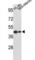 Gasdermin B antibody, abx033996, Abbexa, Western Blot image 