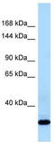 Collagen Type XXI Alpha 1 Chain antibody, TA343211, Origene, Western Blot image 