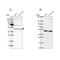 Campylobacter jejuni antibody, NBP1-89049, Novus Biologicals, Western Blot image 