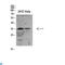 Suppressor Of Cytokine Signaling 2 antibody, LS-C813935, Lifespan Biosciences, Western Blot image 