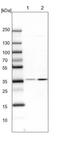 Protein Phosphatase 2 Catalytic Subunit Alpha antibody, NBP2-46693, Novus Biologicals, Western Blot image 