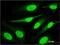 Periphilin 1 antibody, H00051535-M01, Novus Biologicals, Immunofluorescence image 