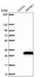 ADP Ribosylation Factor Related Protein 1 antibody, NBP2-14306, Novus Biologicals, Western Blot image 