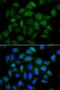 Alpha Fetoprotein antibody, orb48271, Biorbyt, Immunocytochemistry image 