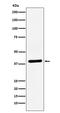 Vascular Endothelial Growth Factor D antibody, M32333-2, Boster Biological Technology, Western Blot image 