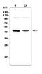 Wnt Family Member 5A antibody, PB9063, Boster Biological Technology, Western Blot image 