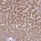 Aspartate Beta-Hydroxylase Domain Containing 1 antibody, NBP1-91686, Novus Biologicals, Immunohistochemistry frozen image 