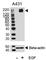 ERBB2 antibody, F48697-0.4ML, NSJ Bioreagents, Western Blot image 