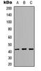 Armadillo Repeat Containing X-Linked 1 antibody, LS-C358411, Lifespan Biosciences, Western Blot image 
