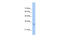 High Mobility Group Nucleosome Binding Domain 5 antibody, 28-744, ProSci, Western Blot image 