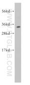 High Mobility Group Box 2 antibody, 14597-1-AP, Proteintech Group, Western Blot image 