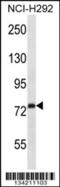 Rabphilin 3A antibody, 57-500, ProSci, Western Blot image 