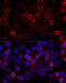Histone Deacetylase 6 antibody, GTX02885, GeneTex, Immunofluorescence image 