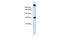 Sucrase-Isomaltase antibody, ARP44830_P050, Aviva Systems Biology, Western Blot image 