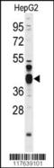 Flap Structure-Specific Endonuclease 1 antibody, TA324746, Origene, Western Blot image 