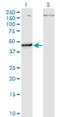 Pseudouridine Synthase 1 antibody, H00080324-M01, Novus Biologicals, Western Blot image 