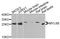 Myosin Light Chain 6B antibody, A9996, ABclonal Technology, Western Blot image 