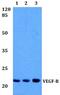 Vascular Endothelial Growth Factor B antibody, A04494, Boster Biological Technology, Western Blot image 