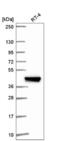 Interferon Induced Protein With Tetratricopeptide Repeats 5 antibody, NBP2-56869, Novus Biologicals, Western Blot image 