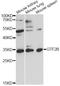 General Transcription Factor IIB antibody, A1708, ABclonal Technology, Western Blot image 