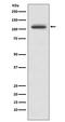 Protein Tyrosine Kinase 2 Beta antibody, M01066, Boster Biological Technology, Western Blot image 