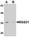 Regulator Of G Protein Signaling 21 antibody, orb75213, Biorbyt, Western Blot image 