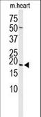 Heat Shock Protein Family B (Small) Member 6 antibody, LS-C165069, Lifespan Biosciences, Western Blot image 