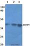 Acyl-CoA Thioesterase 9 antibody, LS-C412090, Lifespan Biosciences, Western Blot image 
