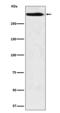 Mucin 5B, Oligomeric Mucus/Gel-Forming antibody, M00719, Boster Biological Technology, Western Blot image 