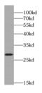 Hydroxylysine Kinase antibody, FNab04815, FineTest, Western Blot image 