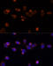 Pyruvate Dehydrogenase E1 Alpha 1 Subunit antibody, 16-941, ProSci, Immunofluorescence image 