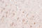 PD-L1 antibody, LS-C746930, Lifespan Biosciences, Immunohistochemistry paraffin image 