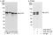 Chaperonin Containing TCP1 Subunit 5 antibody, A303-481A, Bethyl Labs, Western Blot image 