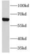 Transmembrane Protein 87A antibody, FNab08791, FineTest, Western Blot image 