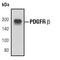 Platelet Derived Growth Factor Receptor Beta antibody, MA5-15103, Invitrogen Antibodies, Western Blot image 