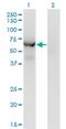 Chaperonin Containing TCP1 Subunit 8 Like 2 antibody, H00150160-M09, Novus Biologicals, Western Blot image 