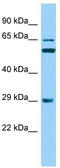 RAB19, Member RAS Oncogene Family antibody, TA334360, Origene, Western Blot image 