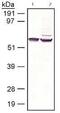 Retinoid Isomerohydrolase RPE65 antibody, MA1-16578, Invitrogen Antibodies, Western Blot image 